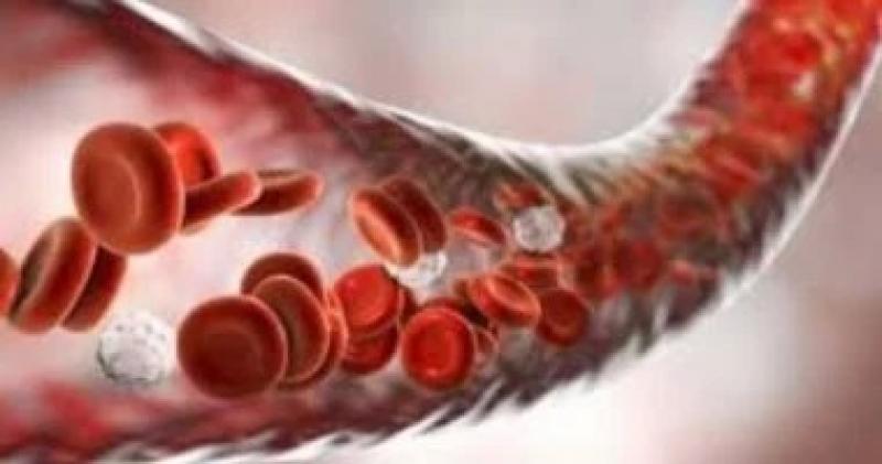 5 علامات غير متوقعة تشير إلى أن جسمك يعانى من نقص الحديد