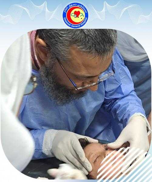 ”استخدموا حنة بدل الكحل”.. تدخل طبي عاجل لإنقاذ بصر 3 أطفال بمستشفى دسوق العام