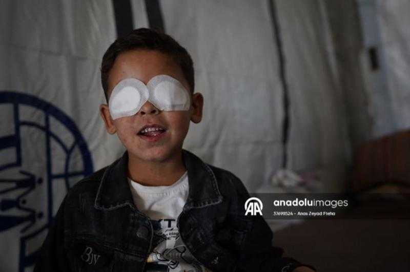 الطفل حجازي.. إسرائيل سرقت عينه والحصار فاقم معاناته