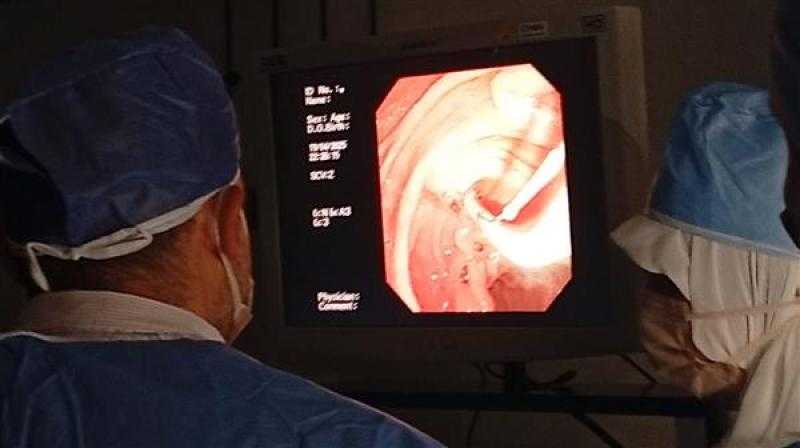 محافظ الغربية: أول عملية منظار قنوات مرارية وتركيب دعامات داخل مستشفى كفرالزيات العام