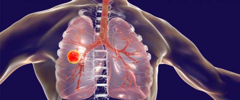 ”الصحة”: توفير أحدث أجهزة تشخيص الدرن ستساعد على الاكتشاف المبكر للمرض وتقليل فرص العدوى