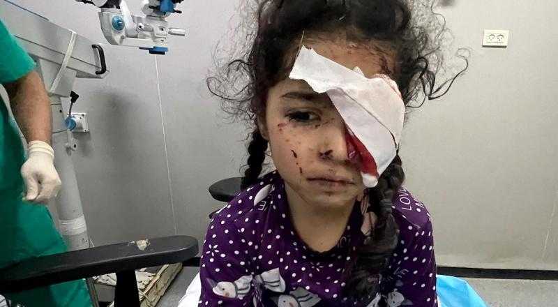 تقرير: 1500 فلسطيني فقدوا البصر بسبب الحرب في غزة