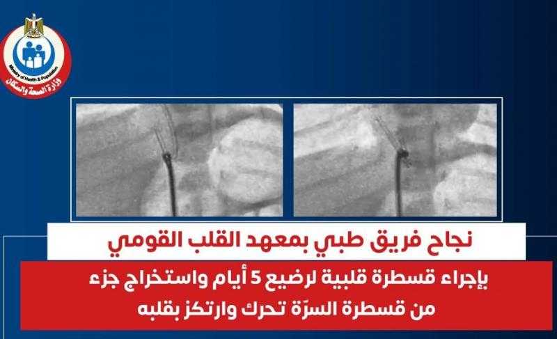 نجاح فريق طبي بمعهد القلب القومي بإجراء قسطرة قلبية لرضيع 5 أيام