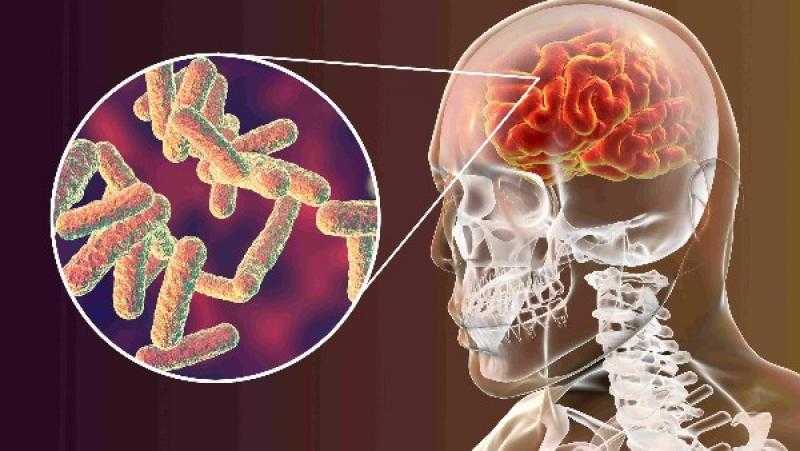 معلومات تهمك.. اعرف أعراض الالتهاب السحائي