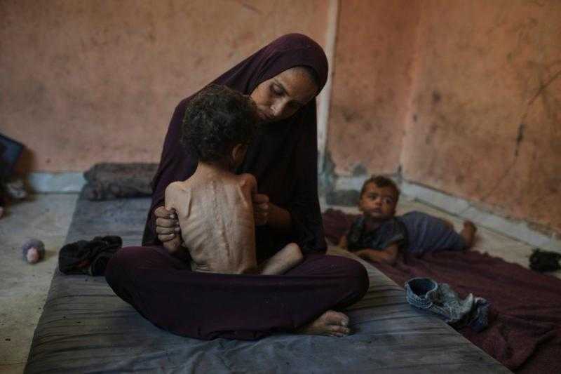 شهداء الجوع في غزة.. 5 وفيات بينهم طفلان نتيجة المجاعة وسوء التغذية
