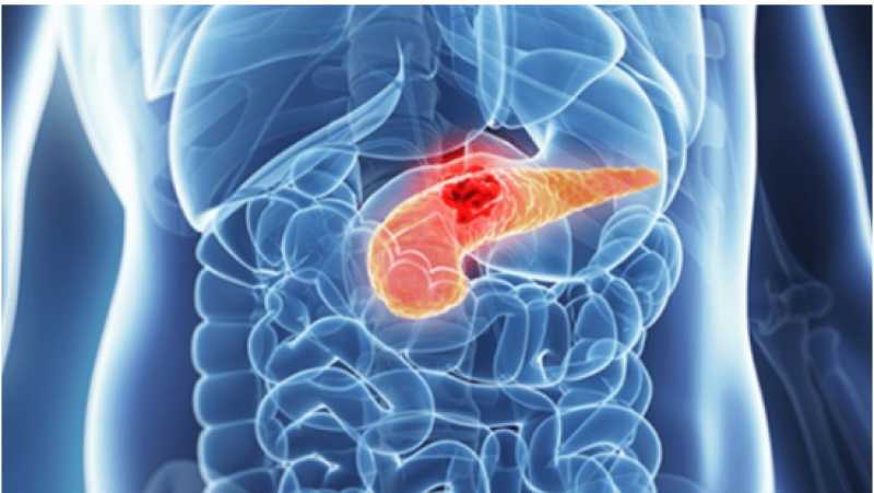 أسامة حمدي: البنكرياس الصناعي سيتم تطبيقه قريبا في مصر لأول مرة