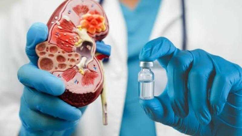 حسام موافي: هؤلاء الأشخاص أكثر عرضة للإصابة بالفشل الكلوي الحاد