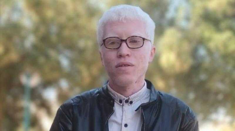 من قمة التفوق إلى صدمة الاستبعاد.. يوسف الأول على قسم التاريخ يُحرم من التعيين بسبب ضعف بصره
