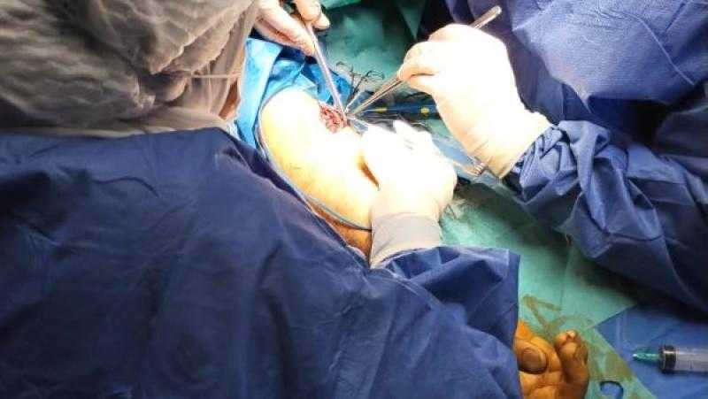 إجراء جراحة عاجلة لإنقاذ ذراع مريض من البتر بمستشفى أبوكبير