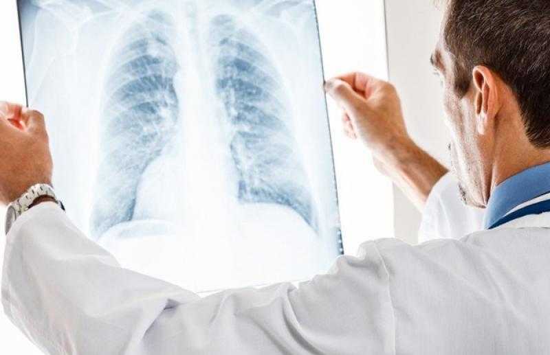 متحدث «الصحة»: نتحرك بخطى جادة لمواجهة أمراض الرئة.. ونسعى لمجتمع خالٍ من الأمراض