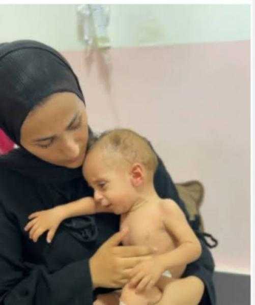 الرضيع الفلسطينى أنس أبو سعيد يسافر للعلاج فى إيطاليا