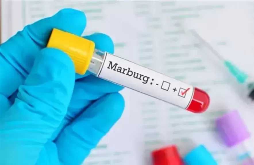 وزارة الصحة: ماربورج فيروس نادر.. وتؤكد: الوضع الصحى بمصر آمن