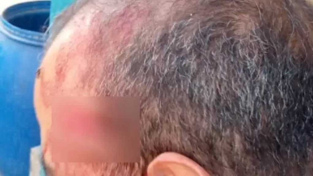 اعتداء دموي على معلم داخل مدرسة بالإسماعيلية بسبب “موبايل” طالبة