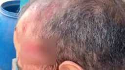 اعتداء دموي على معلم داخل مدرسة بالإسماعيلية بسبب “موبايل”... اعتداء دموي على معلم داخل مدرسة بالإسماعيلية بسبب “موبايل” طالبة