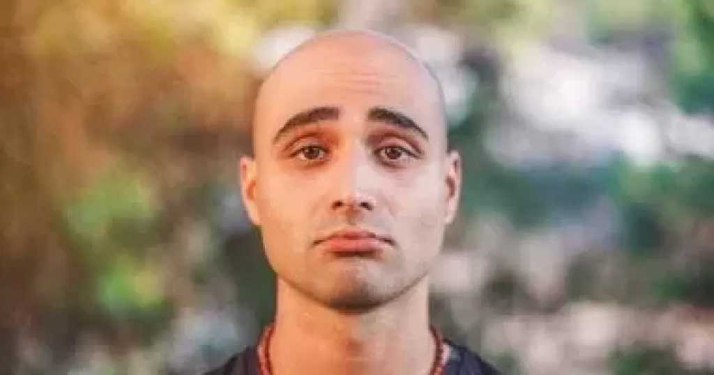 ‏Gen Z أكثر عرضة للصلع من الأجيال السابقة.. استشارى توضح الأسباب