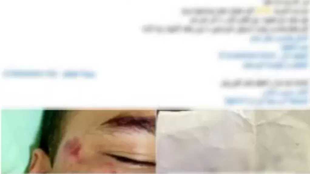 القبض على المتهم بدهس طالب في المقطم