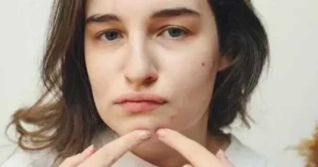 كيف تعالج حب الشباب وندباته بأكلات .. وأخرى ممنوعة عنك