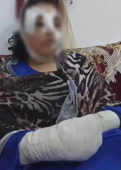 ضربها بعكاز حديدي.. ضبط طالب بتهمة التعدي على شقيقته بالشرقية