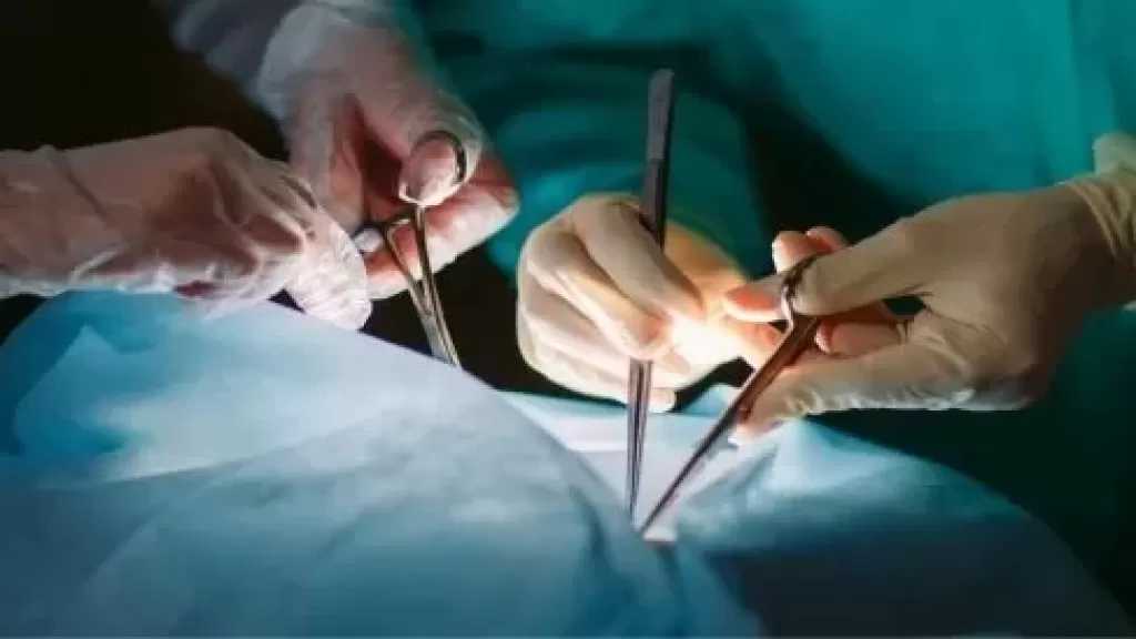 رائد زراعة الكبد: التبرع بالأنسجة محسوم دينيًا ولا داعي لإثارة الجدل من جديد