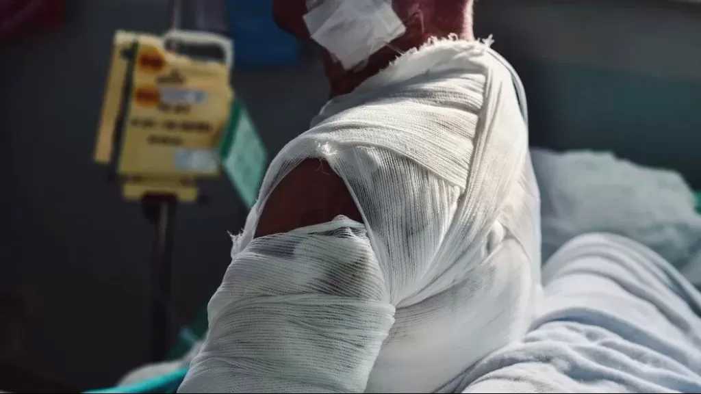 جراح تجميل: إنشاء بنك جلد قضية أمن قومي لعلاج مرضى الحروق