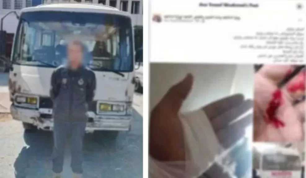 ضبط سائق ميكروباص لاعتدائه على شخص وإصابته بالقاهرة