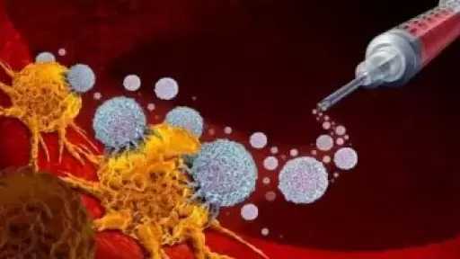 طفرة فى علاج سرطان البنكرياس.. لقاح جديد بفعالية كبيرة يزيد فرص الحياة