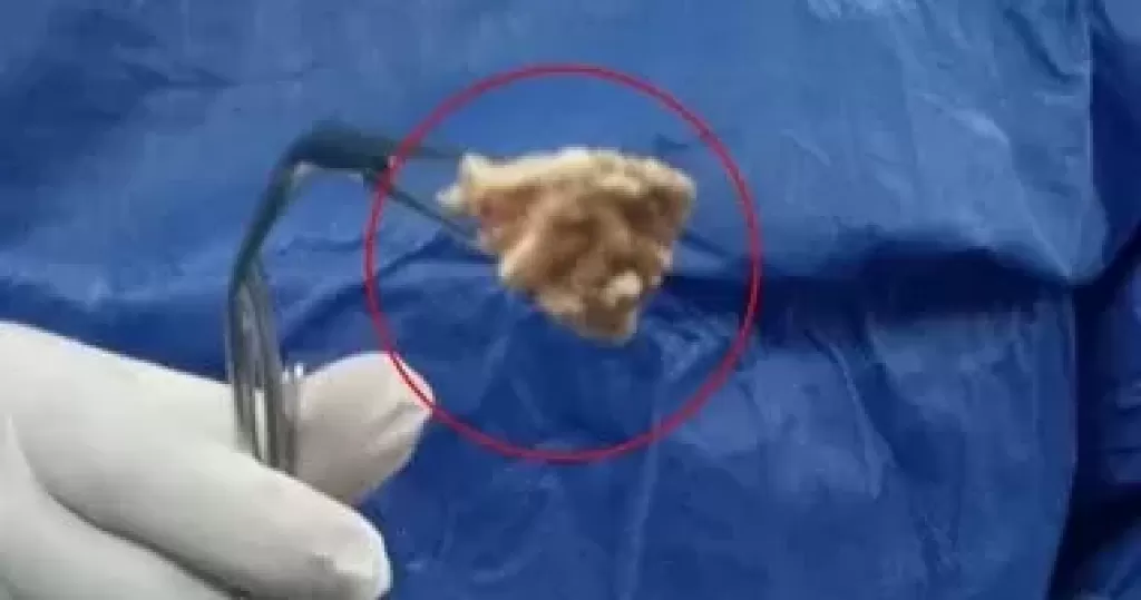 خط أحمر
