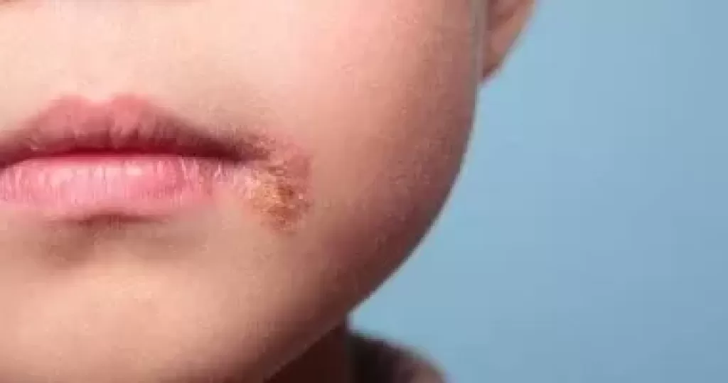 خط أحمر