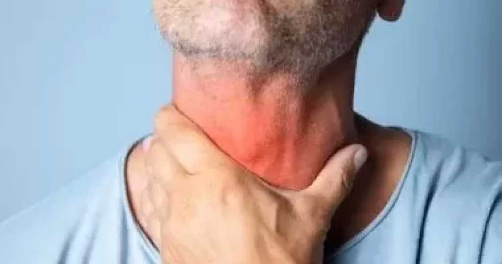 7 علامات مبكرة لسرطان الفم.. لا تتجاهل البقع البيضاء وصعوبة البلع