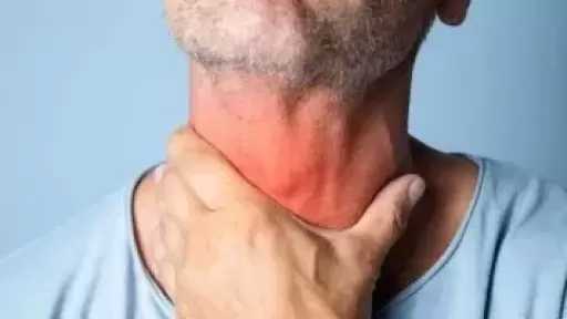 7 علامات مبكرة لسرطان الفم.. لا تتجاهل البقع البيضاء وصعوبة البلع