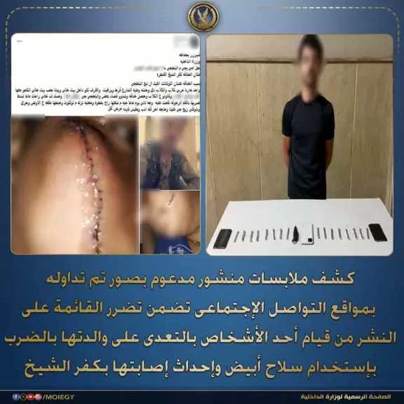 ”الداخلية” تكشف ملابسات تعدي أحد الأشخاص على والدتها بالضرب بإستخدام سلاح أبيض وإحداث إصابتها بكفر الشيخ