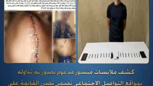 ”الداخلية” تكشف ملابسات تعدي أحد الأشخاص على والدتها بالضرب بإستخدام سلاح أبيض وإحداث إصابتها بكفر الشيخ