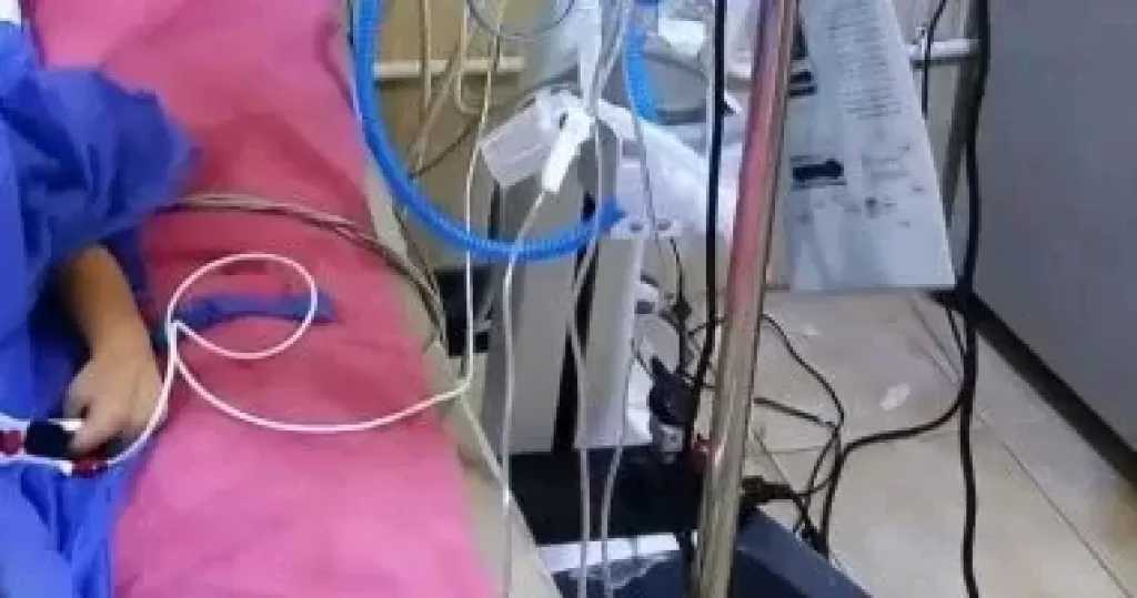 إنقاذ طفل في الثالثة من عمره من نزيف فى المخ بكفر الشيخ