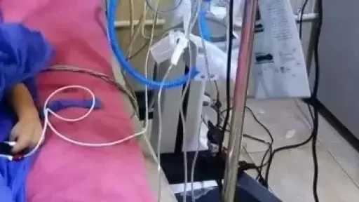إنقاذ طفل في الثالثة من عمره من نزيف فى المخ بكفر الشيخ